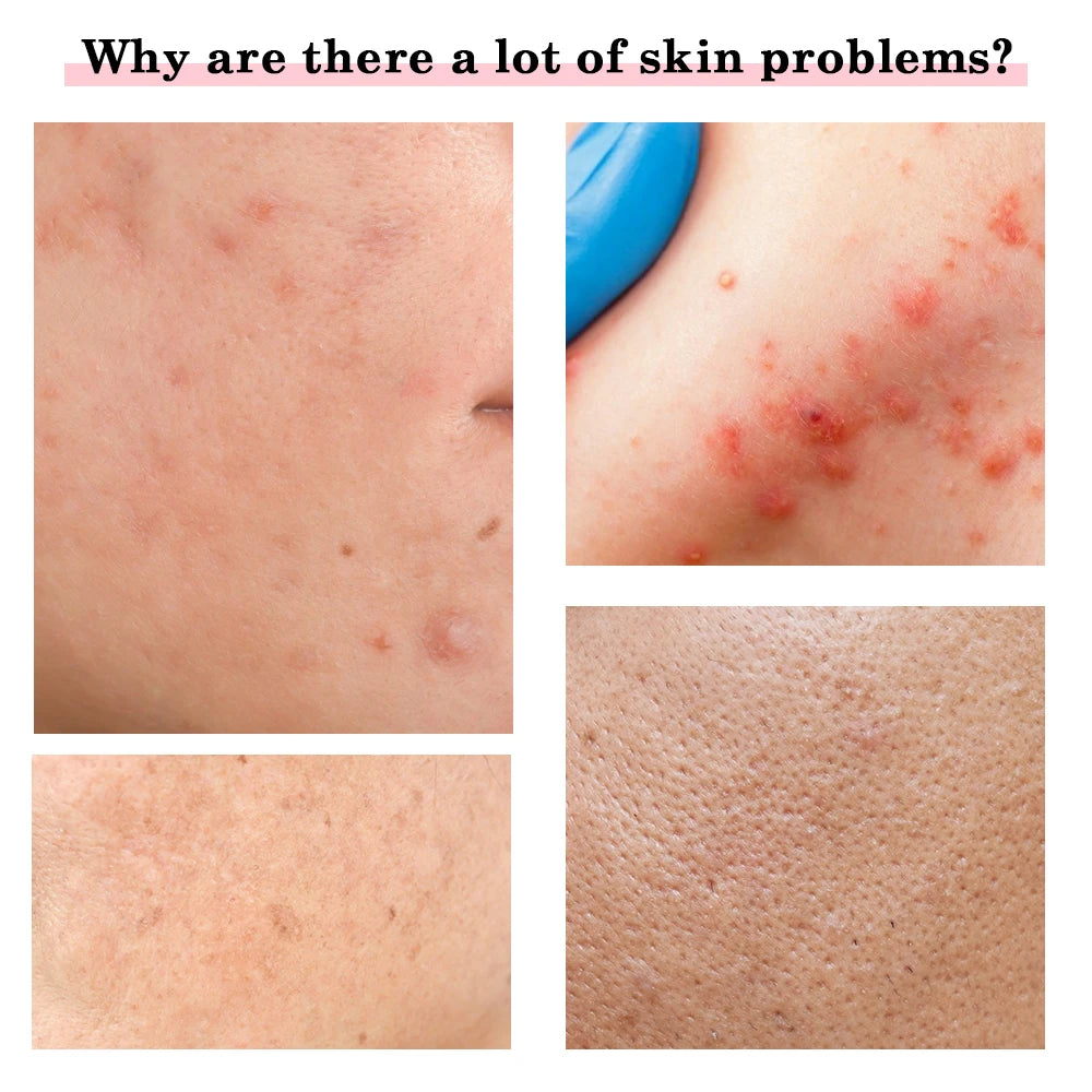 Hailicare Korean Beauty Facial Device – Warm Vibration Massage &amp; LED Light Therapy